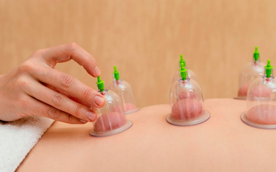 Curso de ventosaterapia