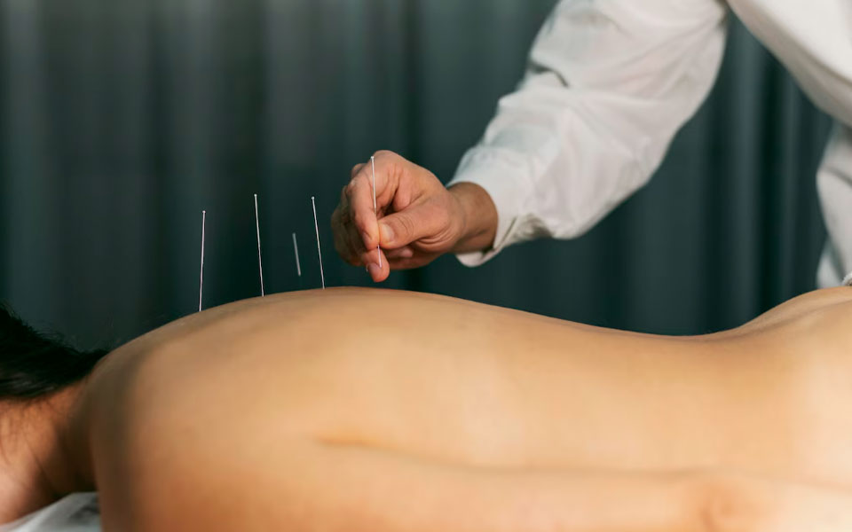 Curso de Ventosaterapia - Acupunturistas