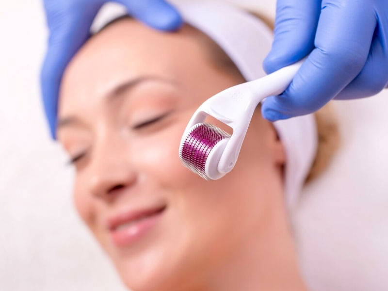 Curso de microagulhamento Profissionais da estética