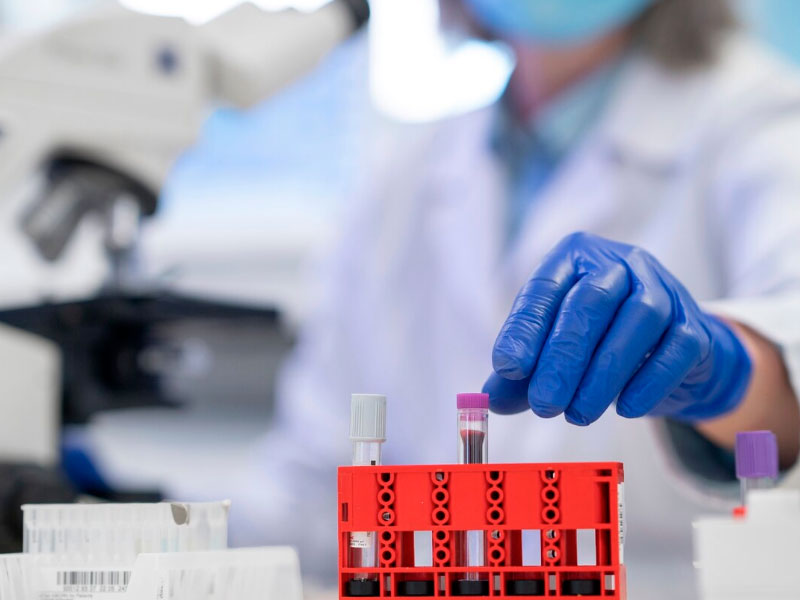 Curso técnico em análises clínicas Áreas de atuação dentro das análises clínicas